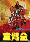 The Kid with the Golden Arm